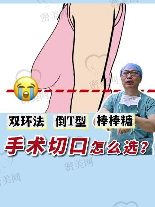 上海海华医院李营乳房下垂矫正：优势特色大集合