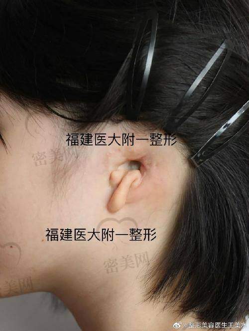上海海华医院：耳再造的“梦幻城堡”
