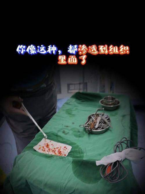 王阔远医生为什么值得选择？术业专攻+闭坑经验