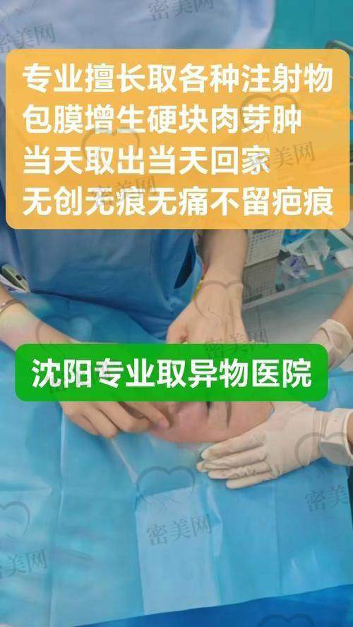 王阔远医生面部减容术的优势，从硬核技术到用户口碑