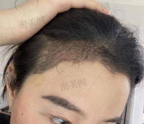 上海瑰丽医疗美容门诊部：个护体验感强，术后舒适