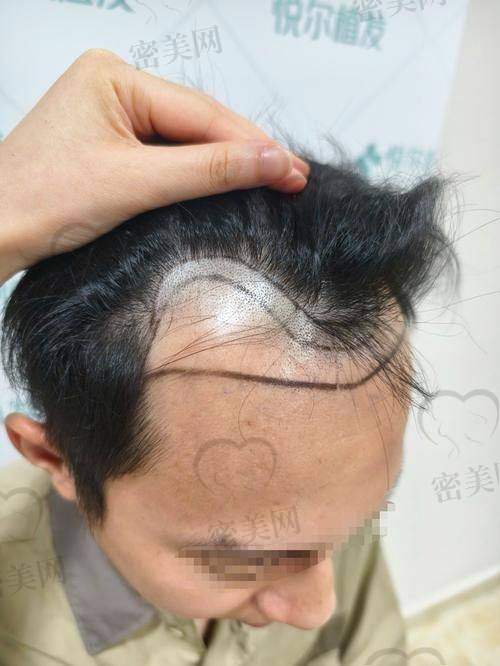 金华显赫植发电话号码：