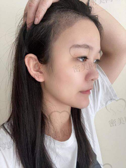 真实患者口碑反馈，中德植发的服务体验如何？