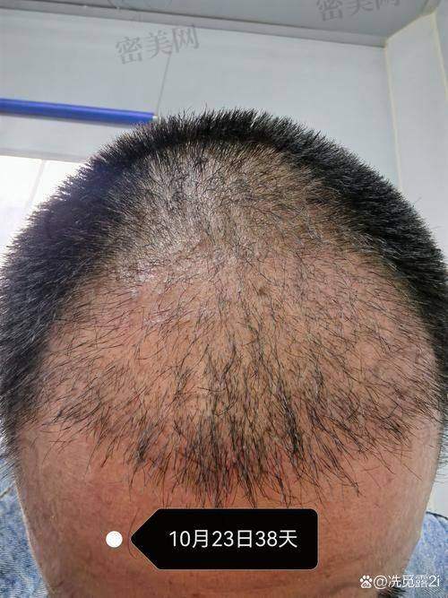 中潭医院整形美容科：技术实稳，成效可期