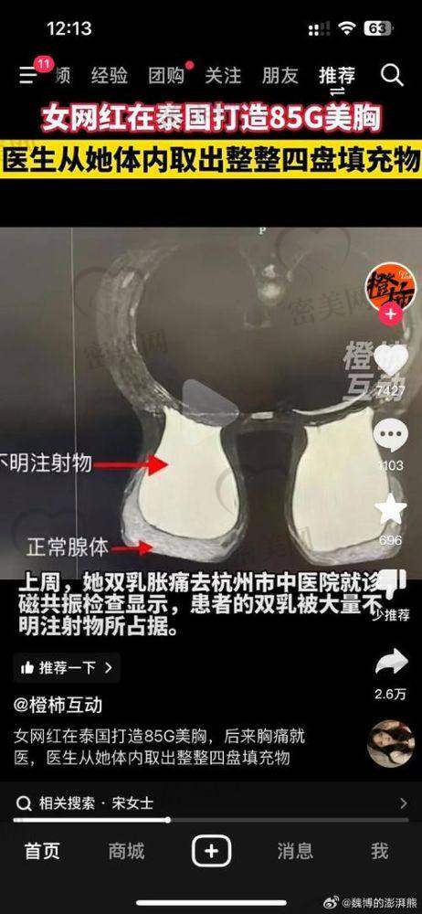 上海海華醫(yī)院李營：技術(shù)優(yōu)勢大揭秘