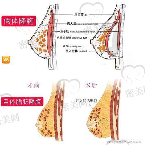 上海艺星陈成医生手术技术特色大揭秘