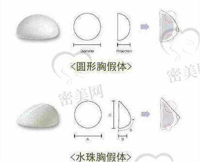 上海艺星陈成曼托假体隆胸的感受体验超棒
