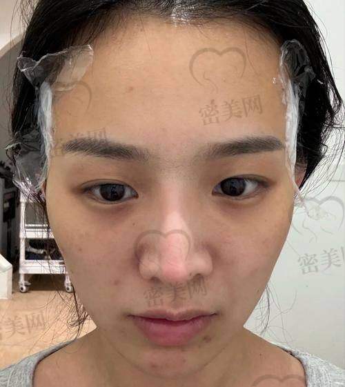 坐等变得更美之前，不妨问自己这几个问题