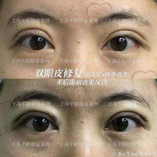 术后修复，惊喜不断