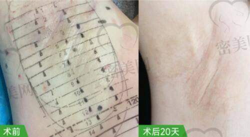 刘苏冰医生擅长项目：