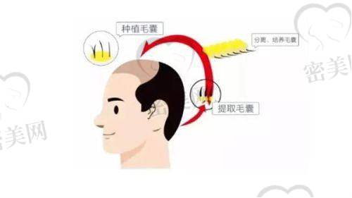 泉州重森植发地址及乘车路线：