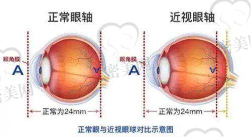 玉林华厦眼科医院医生名单：