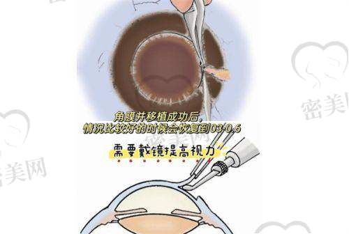 宜昌市中 心人民医院近视眼矫正术收费概览：价格从何而来？