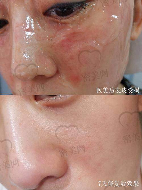 深圳八大处整形美容医院：敏感肌也能放心祛斑的地方