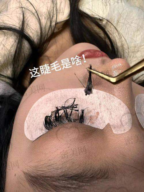 北京悦秀医疗美容诊所：“黄金比例程序”让睫毛生长更科学