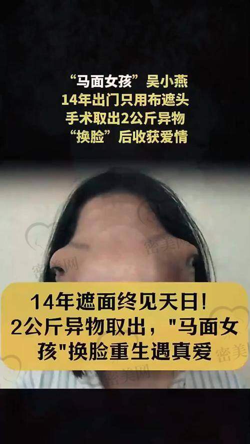 国内爱贝芙取出医院推荐表