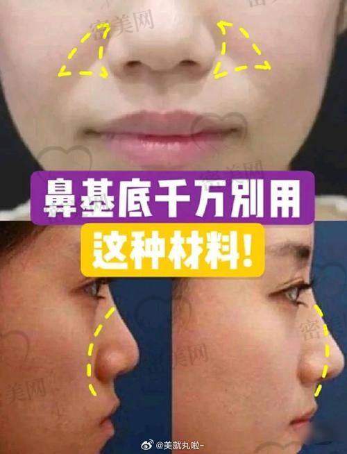 填充前后对比，简直是“换头术”