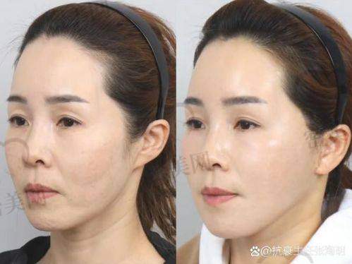 蹇洪医生信息整理：坐诊、项目以及预约方式