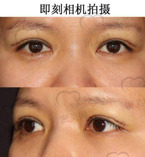 邂逅上海伯思立谈宇腾，修复曙光初现