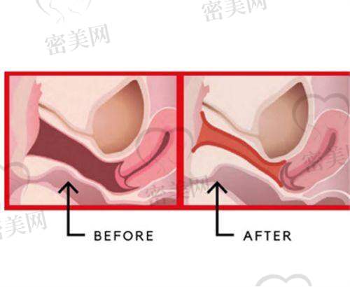 钦州华美整形医院适合哪些人？来看典型实例反馈