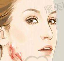 钦州华美整形医院主推项目及价格表明细