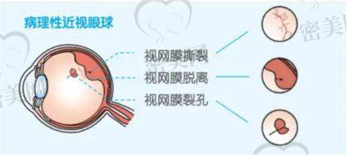 福州东南眼科医院两大院区交通指南