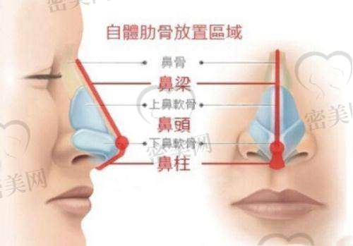 整形攻略