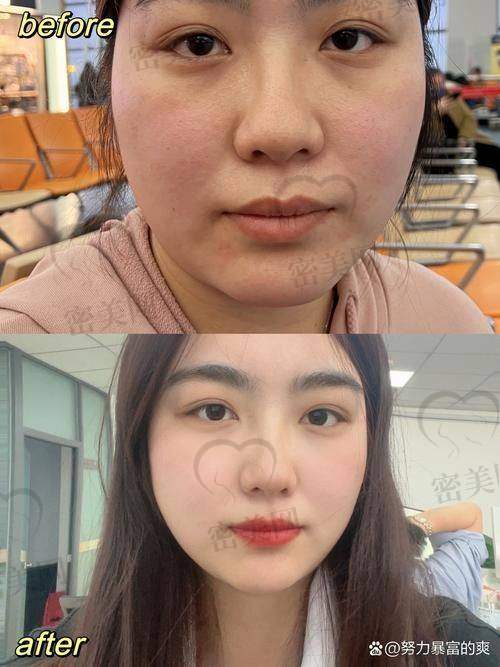 去除法令纹的小妙招和简单方法