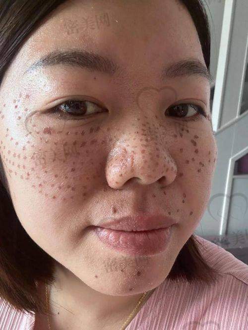 合肥颜可美学医疗美容：轻奢祛斑体验