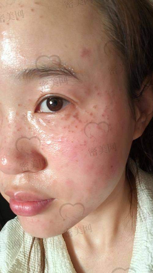 合肥星悦医疗美容：医美界的“美白罚站墙”