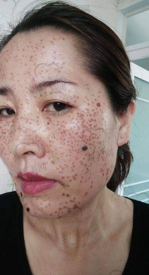 合肥医博美汇医疗美容：术后修复出圈的医院