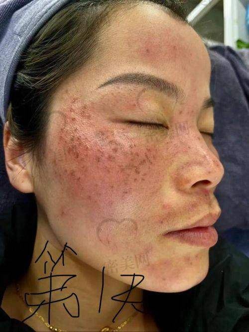 合肥艾诺专精皮肤诊疗中 心：皮肤科出身，技术硬核