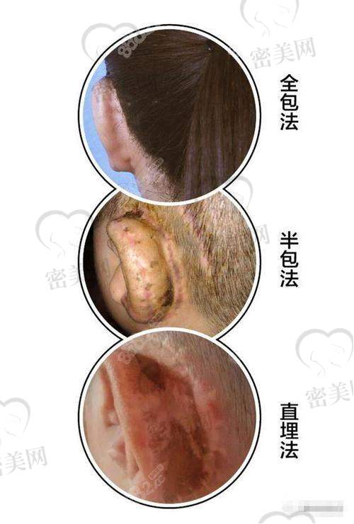 上海海华医院安洪宾：49800 起的美丽魔法价格