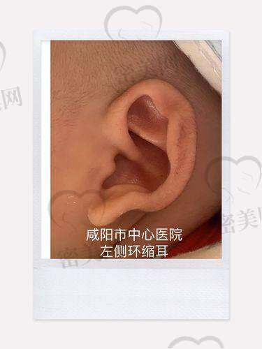 上海海华医院安洪宾：49800 起项目的真人实例