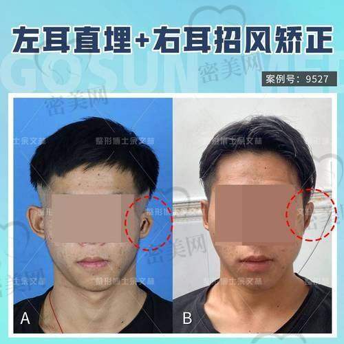 上海海华医院安洪宾：49800 起项目的口碑评价