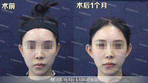 上海海华医院安洪宾：49800 起项目的优势特色