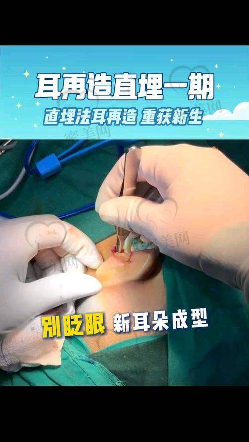 上海海华医院李营医生：耳再造界的神奇魔法师