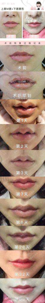 适合不同年龄段的整形项目