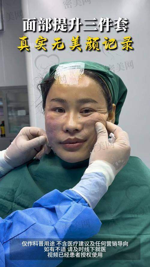 术后修复：惊喜不断的容貌逆袭