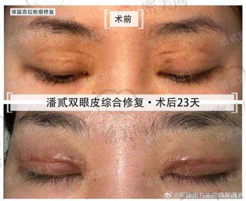 张园园医生口碑怎么样？
