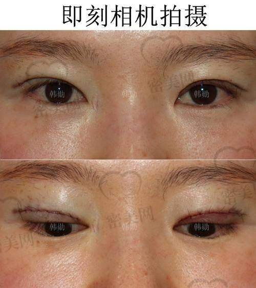 张园园医生擅长项目：