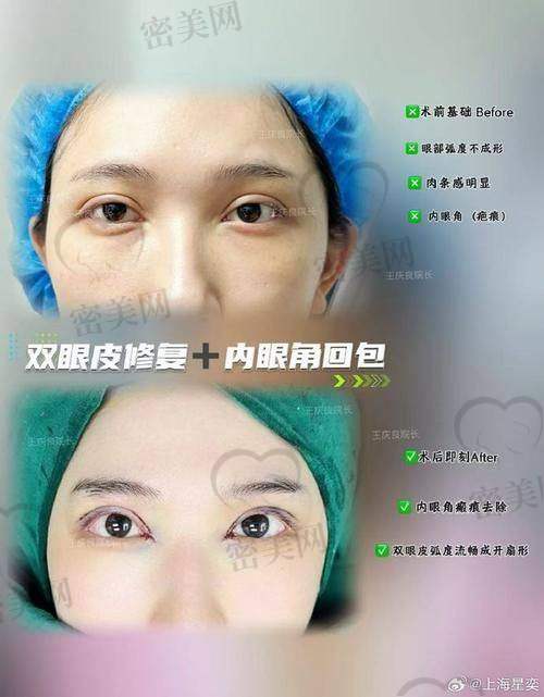 张园园现在哪些医院坐诊？分布多点，预约选择灵活