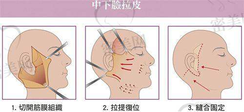 沈阳汇美人医疗美容医院：款型全方面，方案百搭