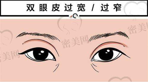 王彤医生:眼整形+脂肪精细化雕刻,细节控优选