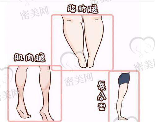沈阳北方整形外科医院：高阶眼袋修复，术后更显年轻