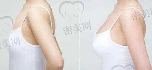 特别提醒：别贪便宜不看医生背景