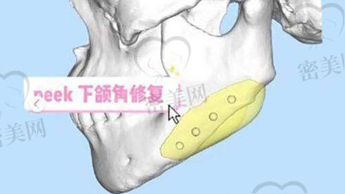 选择王博谦=选择放心改变！