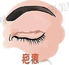 如何预约西安艺星医生？超详细攻略看这里！