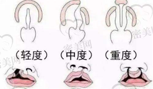 术后成效：生活像开了挂