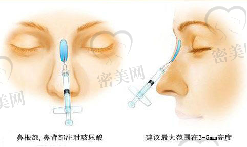 除了隆鼻隆胸,还有哪些医生值得一提?